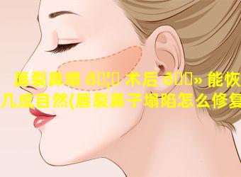 唇裂鼻塌 🦅 术后 🌻 能恢复几成自然(唇裂鼻子塌陷怎么修复做手术多久)